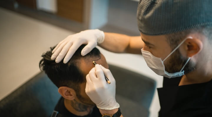 male hair transplant procedure